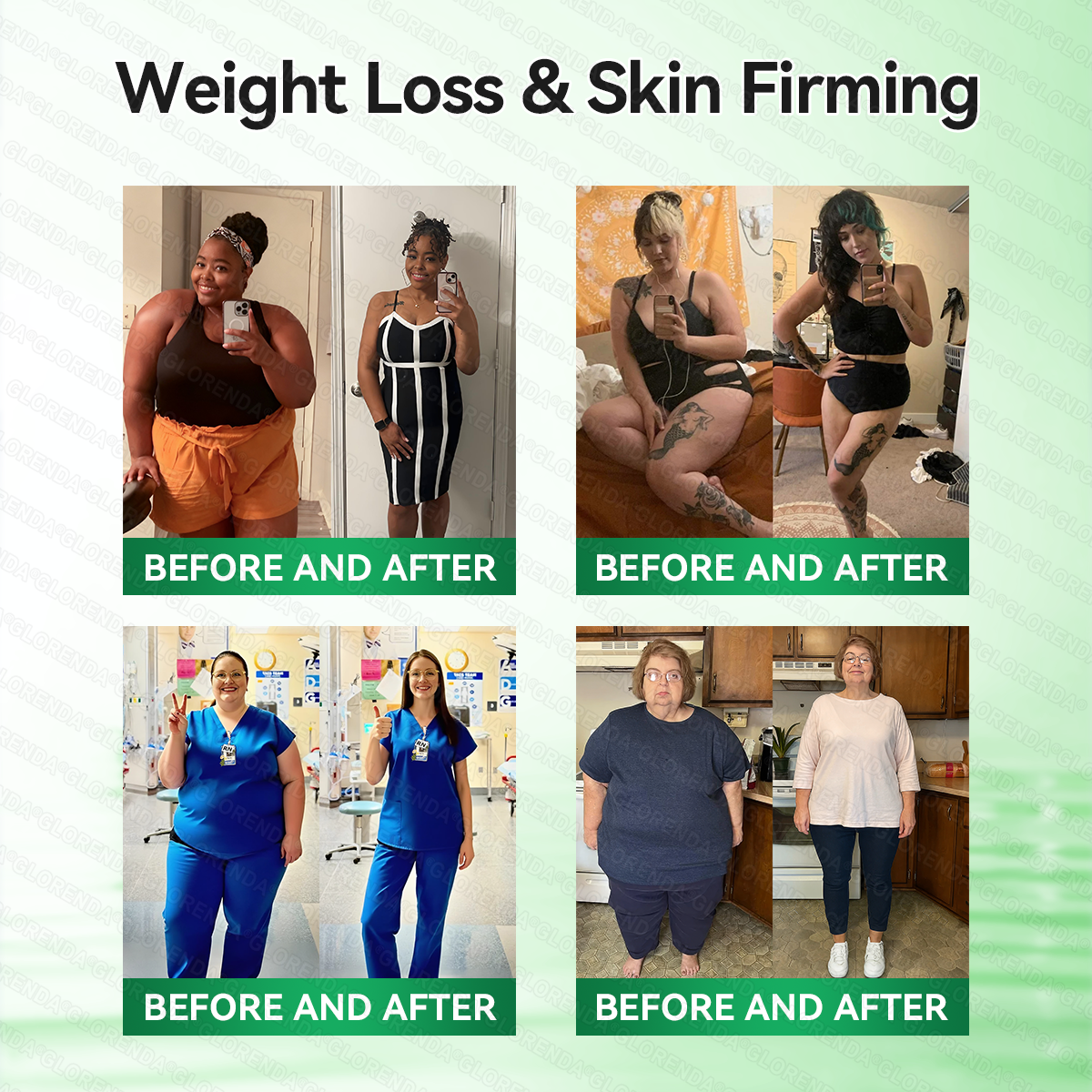 🇿🇦𝑶𝒇𝒇𝒊𝒄𝒊𝒂𝒍 𝑺𝒕𝒐𝒓𝒆 | 🌿🌿𝐆𝑳𝑶𝗥𝗘𝗡𝘿𝘼® 𝙈𝒐𝒓𝒊𝒏𝒈𝗮 · 𝗕𝗲𝗿𝗯𝐞𝐫𝐢𝐧𝙚 × 𝙉𝑨𝑫+ 𝟏𝟎-𝙞𝙣-1 𝘼𝒅𝒗𝒂𝒏𝒄𝒆𝐝 𝐍𝐚𝐧𝙤 𝙈𝙞𝙘𝙧𝙤𝙣𝒆𝒆𝒅𝒍𝐞 𝐏𝐚𝐭𝙘𝙝(𝐉𝐮𝐬𝐭 𝐨𝐧𝐜𝐞 𝐚 𝐝𝐚𝐲, 𝐯𝐢𝐬𝐢𝐛𝐥𝐞 𝐜𝐡𝐚𝐧𝐠𝐞𝐬 𝐢𝐧 𝟕 𝐝𝐚𝐲𝐬） ✅ 𝐅𝐨𝐫 𝐨𝐛𝐞𝐬𝐢𝐭𝐲, 🅛🅞🅞🅢🅔 🅢🅚🅘🅝,𝐝𝐢𝐚𝐛𝐞𝐭𝐞𝐬, 𝐬𝐥𝐞𝐞𝐩 𝐚𝐩𝐧𝐞𝐚, 𝐣𝐨𝐢𝐧𝐭 𝐢𝐬𝐬𝐮𝐞𝐬, 𝐚𝐧𝐝 𝐦𝐨𝐫𝐞