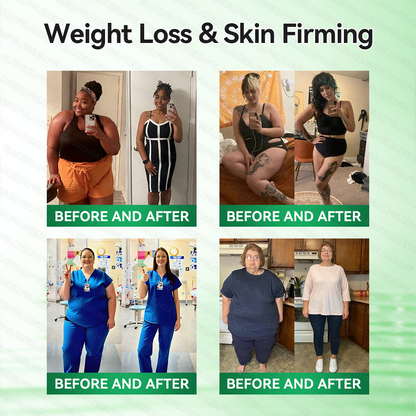 🇿🇦𝑶𝒇𝒇𝒊𝒄𝒊𝒂𝒍 𝑺𝒕𝒐𝒓𝒆 | 🌿🌿𝐆𝑳𝑶𝗥𝗘𝗡𝘿𝘼® 𝙈𝒐𝒓𝒊𝒏𝒈𝗮 · 𝗕𝗲𝗿𝗯𝐞𝐫𝐢𝐧𝙚 × 𝙉𝑨𝑫+ 𝟏𝟎-𝙞𝙣-1 𝘼𝒅𝒗𝒂𝒏𝒄𝒆𝐝 𝐍𝐚𝐧𝙤 𝙈𝙞𝙘𝙧𝙤𝙣𝒆𝒆𝒅𝒍𝐞 𝐏𝐚𝐭𝙘𝙝(𝐉𝐮𝐬𝐭 𝐨𝐧𝐜𝐞 𝐚 𝐝𝐚𝐲, 𝐯𝐢𝐬𝐢𝐛𝐥𝐞 𝐜𝐡𝐚𝐧𝐠𝐞𝐬 𝐢𝐧 𝟕 𝐝𝐚𝐲𝐬） ✅ 𝐅𝐨𝐫 𝐨𝐛𝐞𝐬𝐢𝐭𝐲, 🅛🅞🅞🅢🅔 🅢🅚🅘🅝,𝐝𝐢𝐚𝐛𝐞𝐭𝐞𝐬, 𝐬𝐥𝐞𝐞𝐩 𝐚𝐩𝐧𝐞𝐚, 𝐣𝐨𝐢𝐧𝐭 𝐢𝐬𝐬𝐮𝐞𝐬, 𝐚𝐧𝐝 𝐦𝐨𝐫𝐞